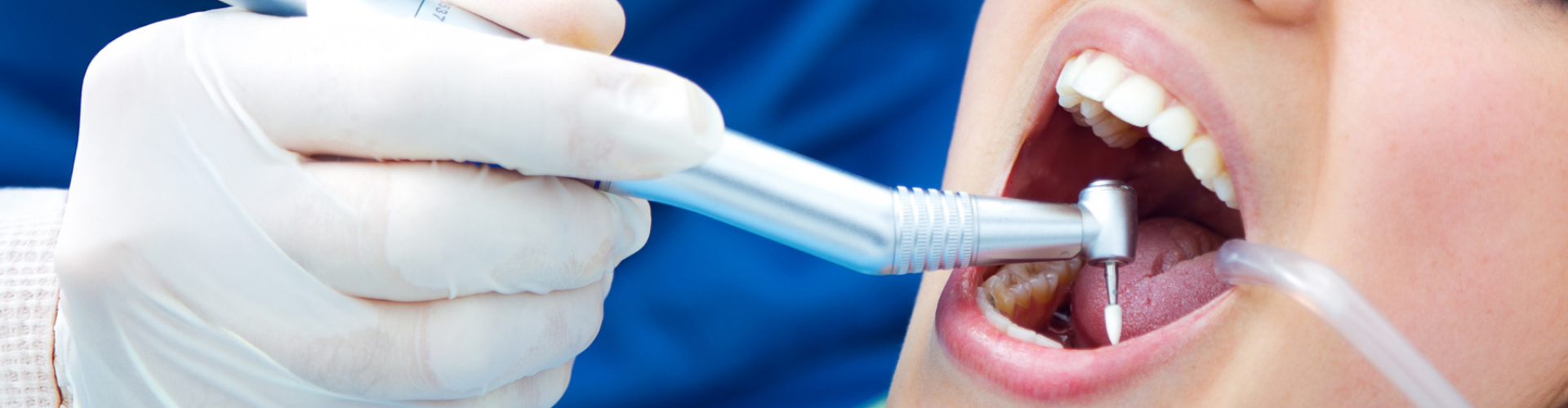 Dentist performing a root canal procedure on a patient's molar using a dental handpiece while suction keeps the treatment area dry.